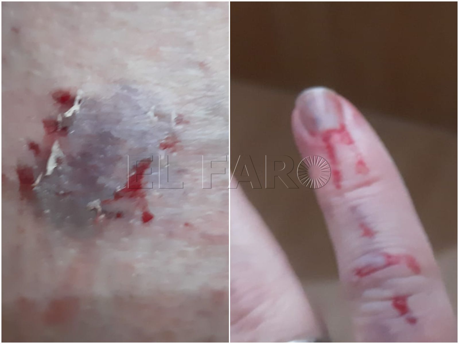 Paz Velázquez anima a las víctimas de un perro sospechoso de rabia a denunciar a Salud Pública