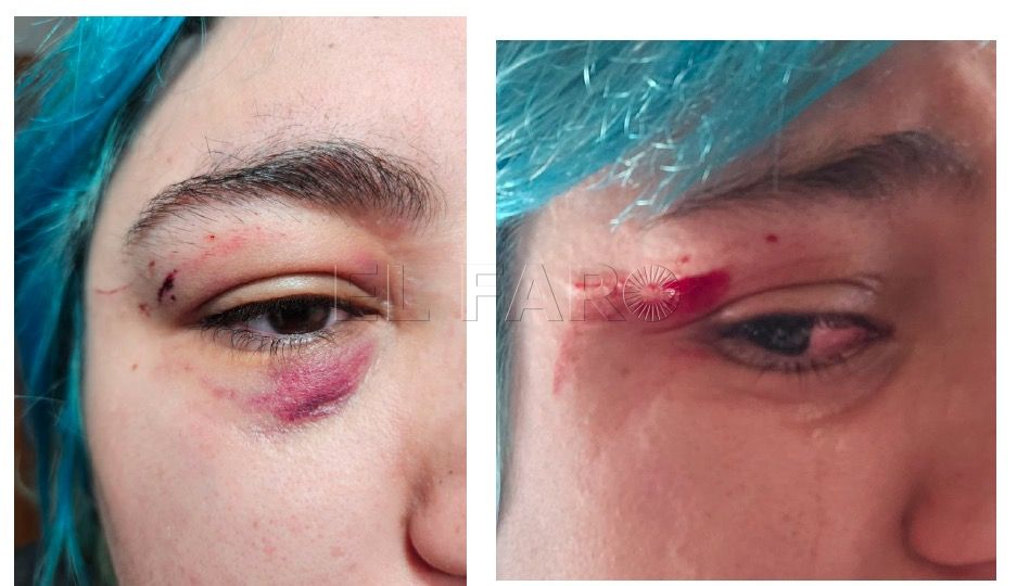 Ataque homófobo a dos chicas con amenazas de muerte