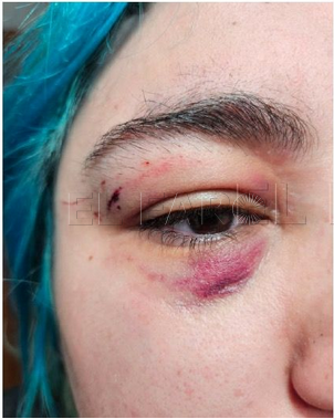 Hay que responder con firmeza