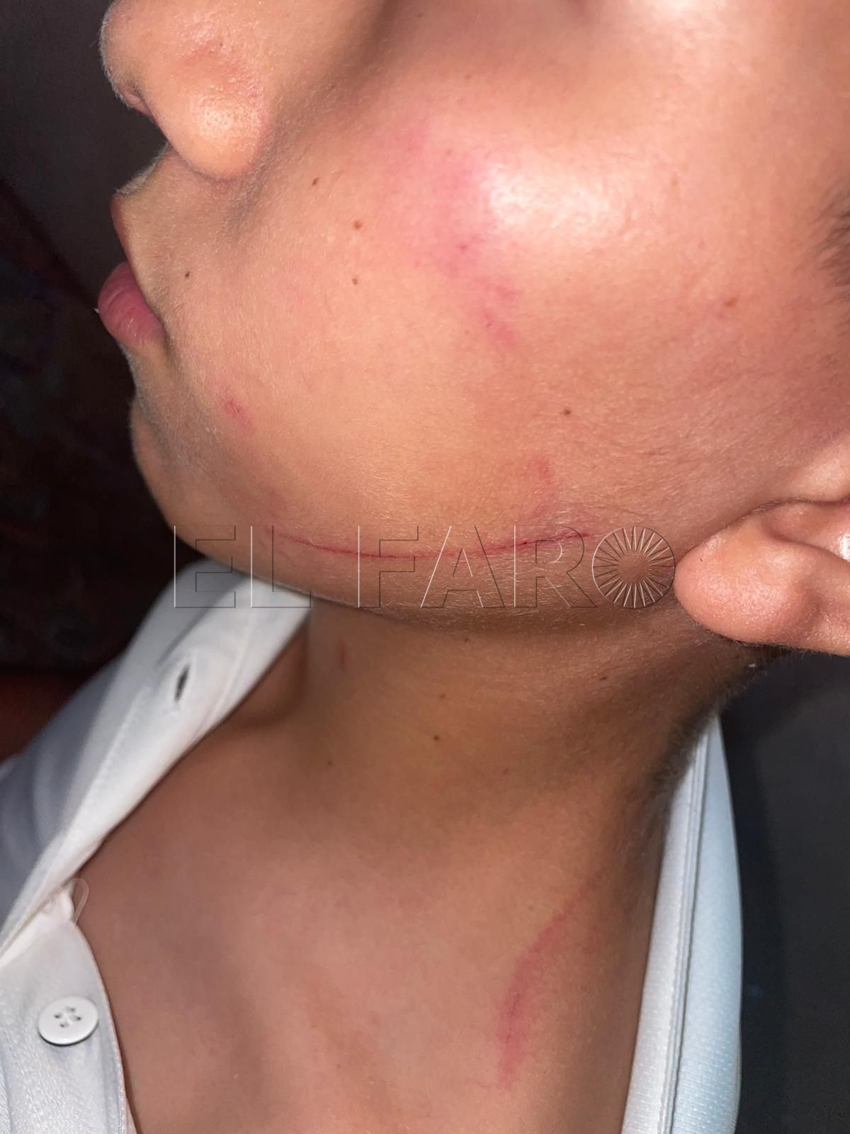 La Fampa respalda a la familia del menor por la agresión en el Enrique Nieto