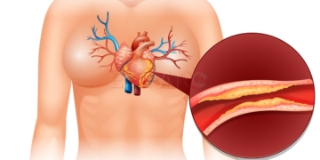 Heart Cholesteral in human illustration