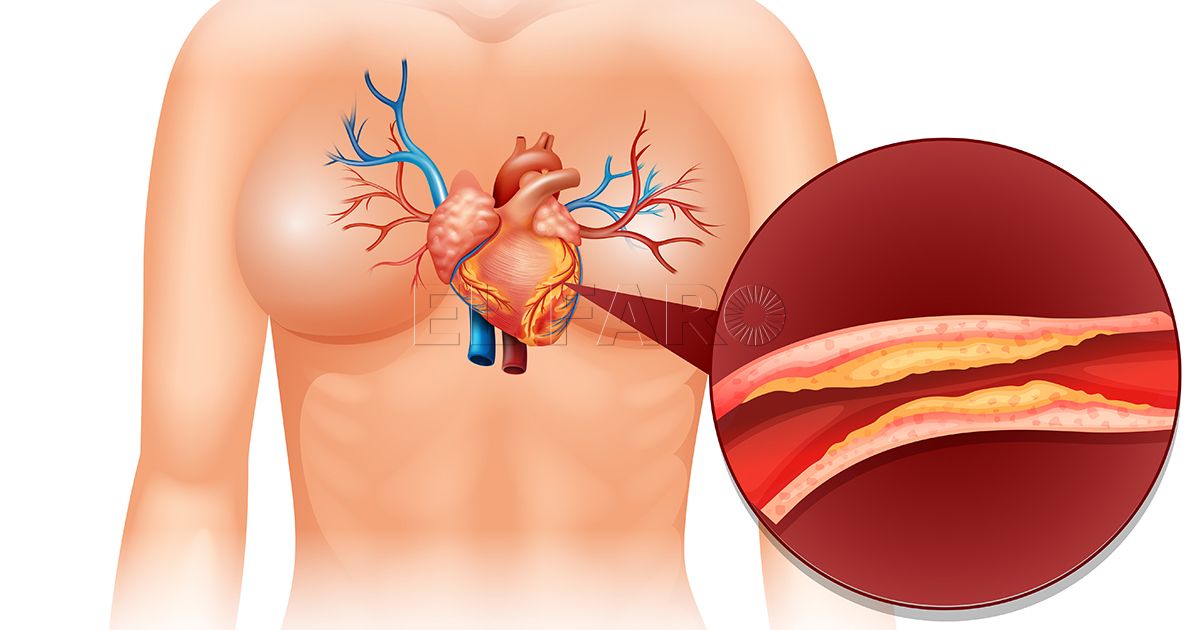 Consejos nutricionales para bajar los niveles de colesterol