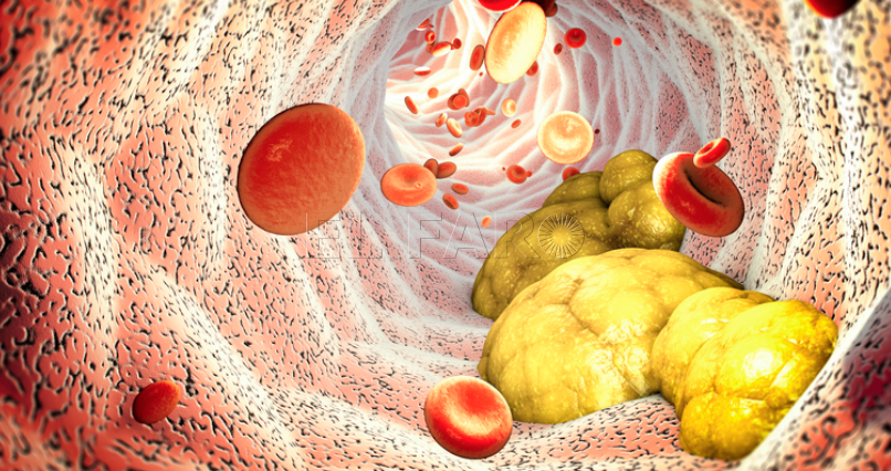 La dietista Marta López Ortuño ofrece consejos nutricionales para cuidar los niveles de triglicéridos