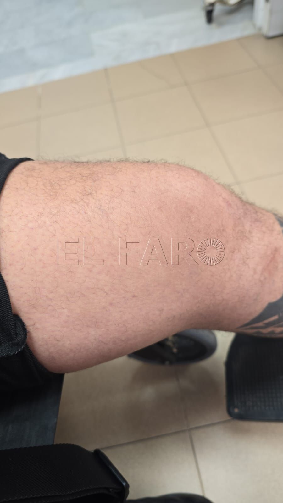 Heridos tres vigilantes en un nuevo apedreamiento en la Purísima