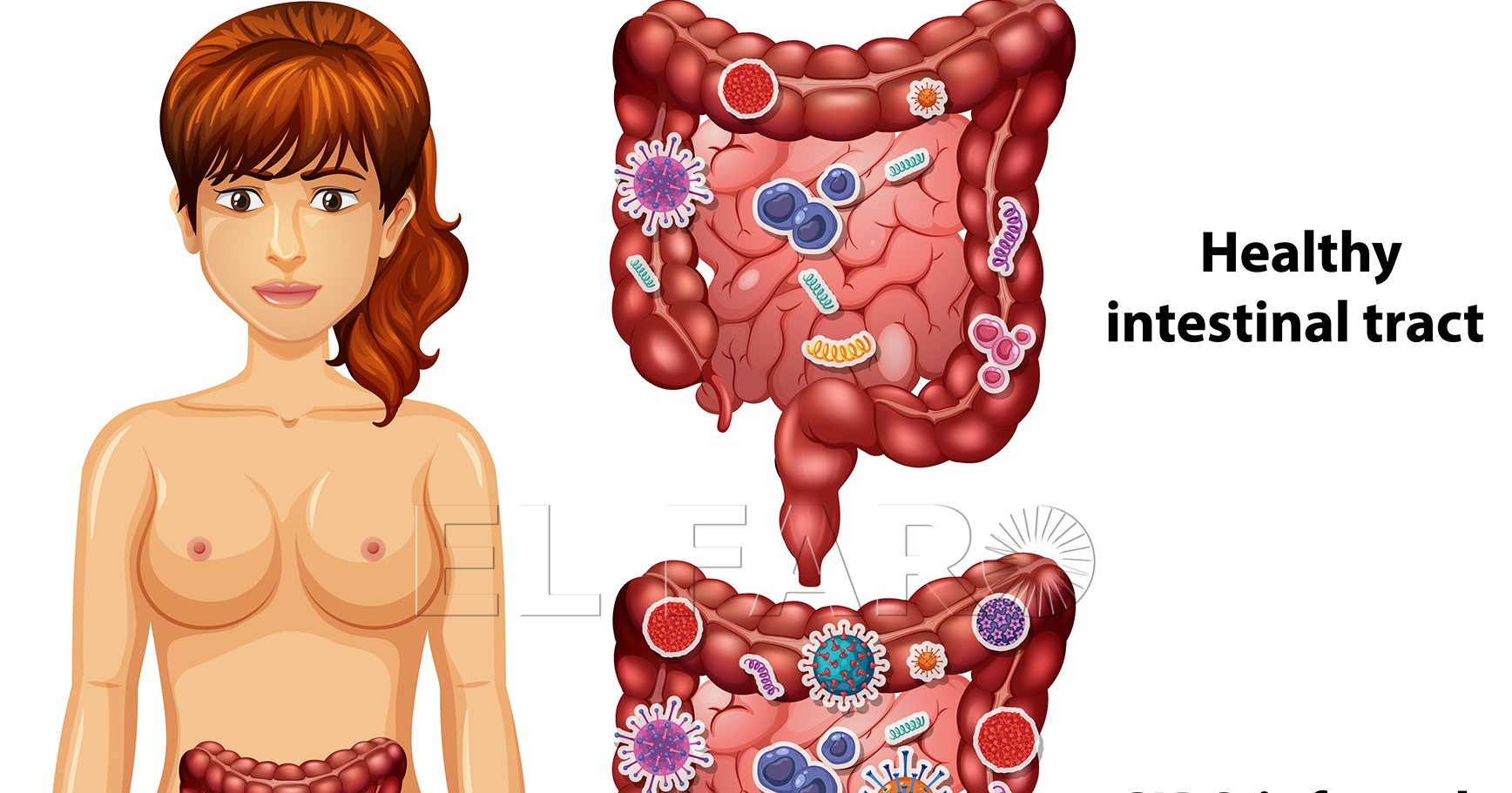 ¿Qué es el SIBO del que todo el mundo habla?