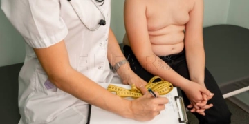 Childhood obesity problem and weight loss. Fat boy at a nutritionist appointment. Overweight boy consulting with doctor in office. Doctor examining fat boy in clinic. Doctor measuring overweight boy.