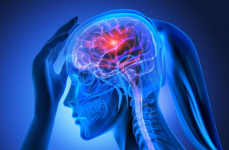 Melilla y Ceuta piden mejor atención neurológica por el aumento de casos de ictus