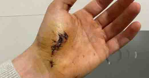 Once puntos en la mano