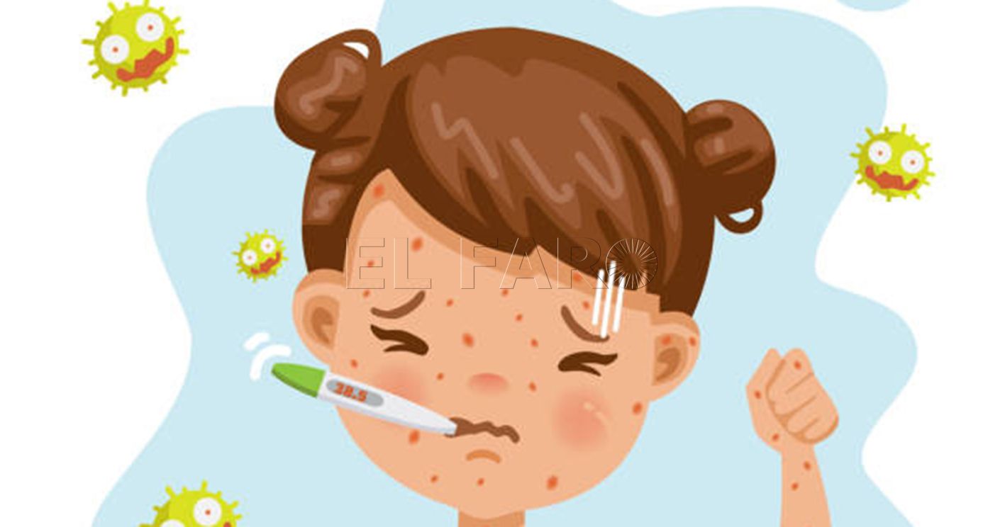 El Ministerio de Sanidad refuerza la formación de sus profesionales para prevenir casos de sarampión