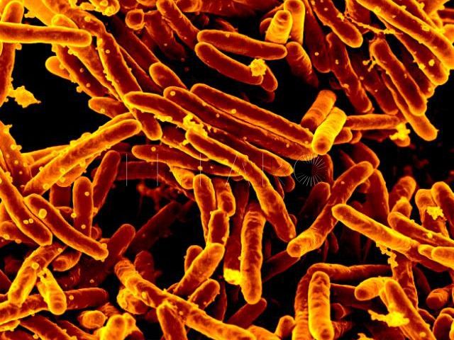 Un nuevo método basado en IA, liderado por la UGR, acerca la identificación rápida de subespecies de ‘Mycobacterium abscessus’