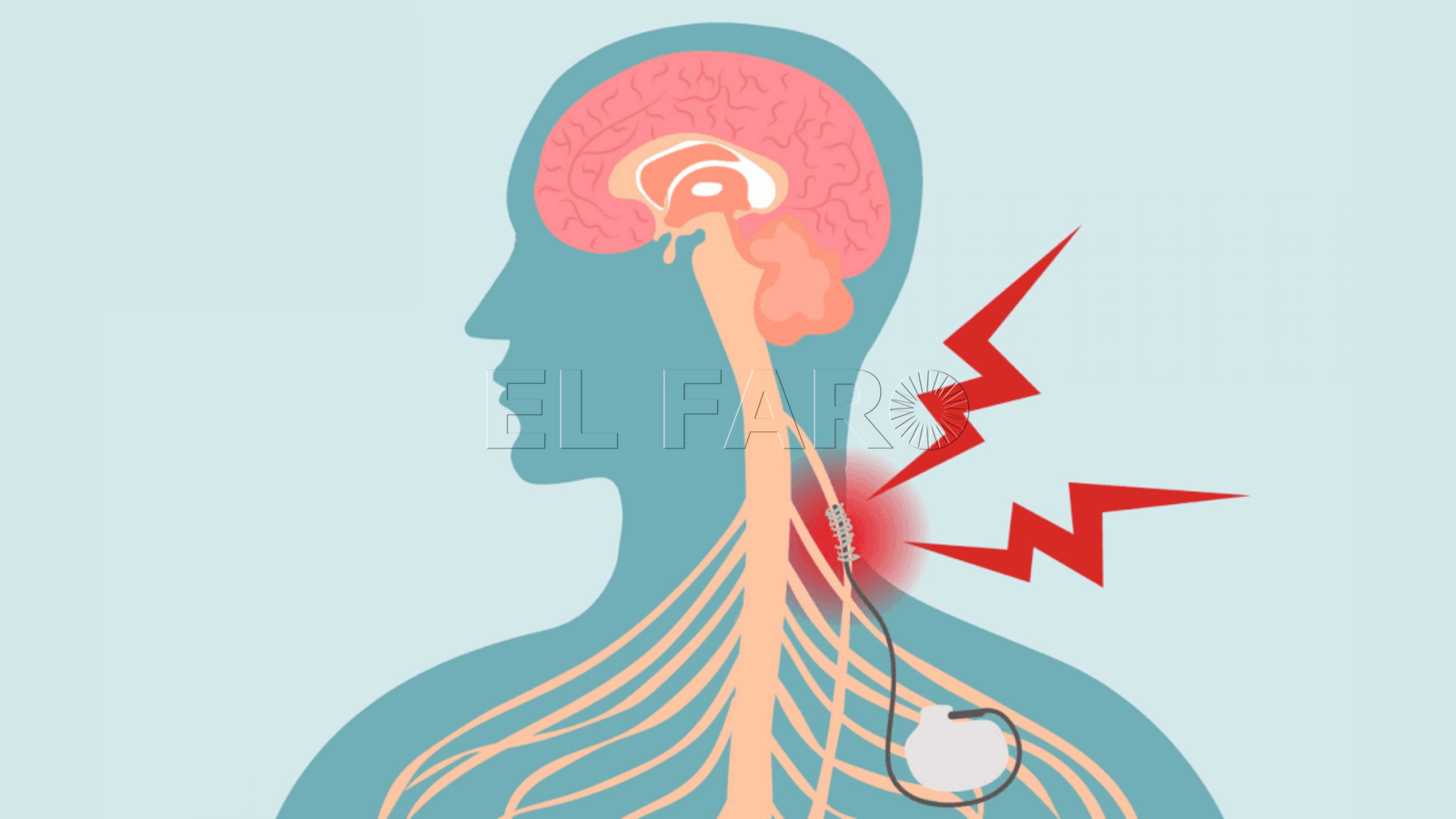 El nervio que, literalmente, vaga por el cuerpo humano y es clave en muchas funciones vitales (Internet)